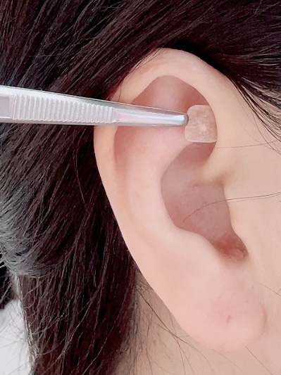 1.ガマンいらずで食欲をコントロール。無理なく痩せる『耳つぼ刺激』