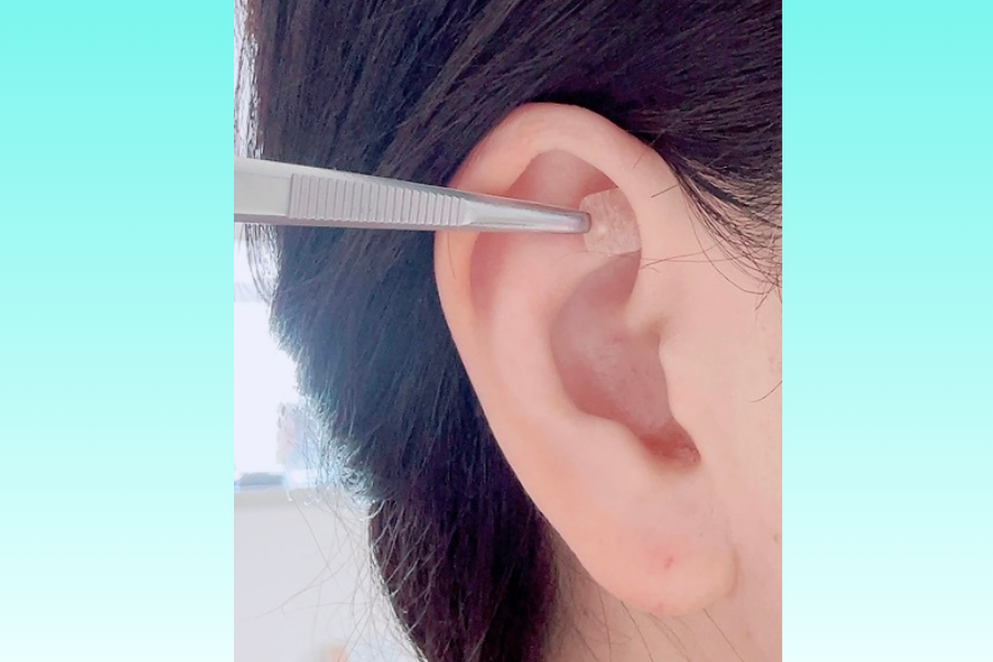 ドキドキの耳つぼお試し体験